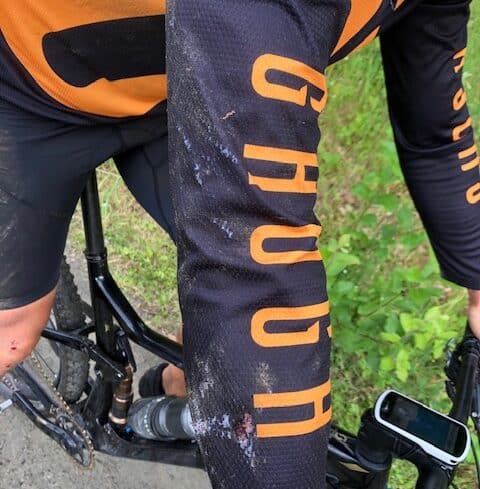 GHOGH_MTB_Fail_skrubbsår